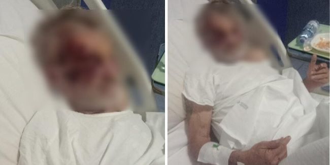 Cosenza, clochard aggredito in piena notte